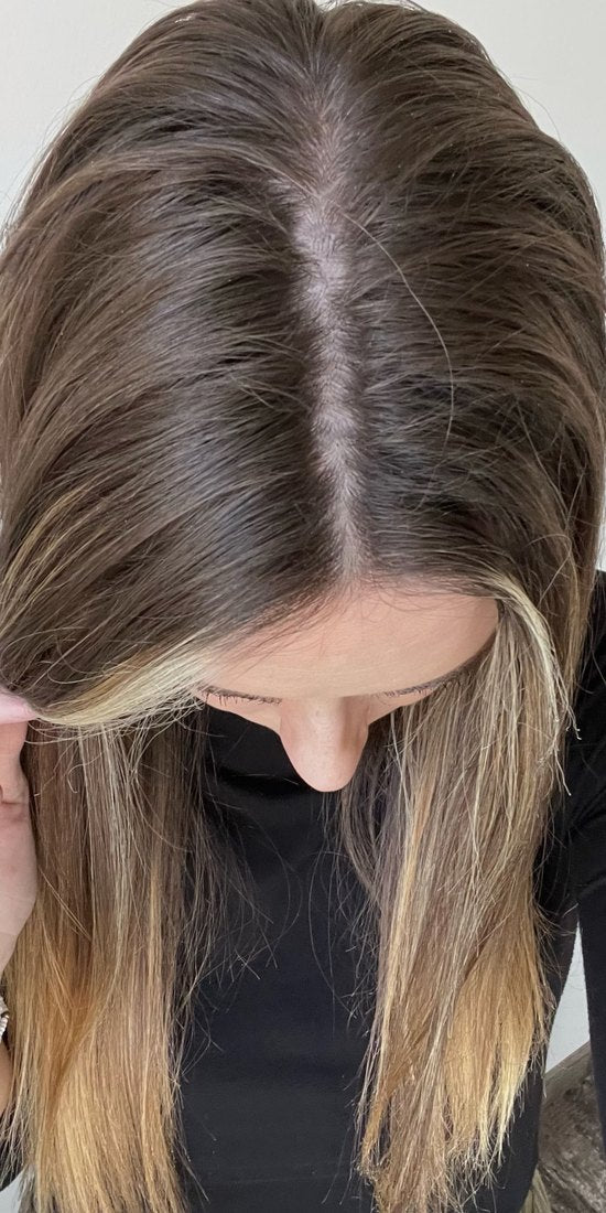 More hair in the brush than on your head